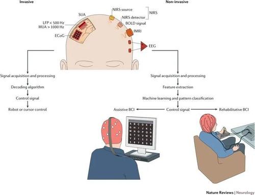 脑机接口研究最新进展